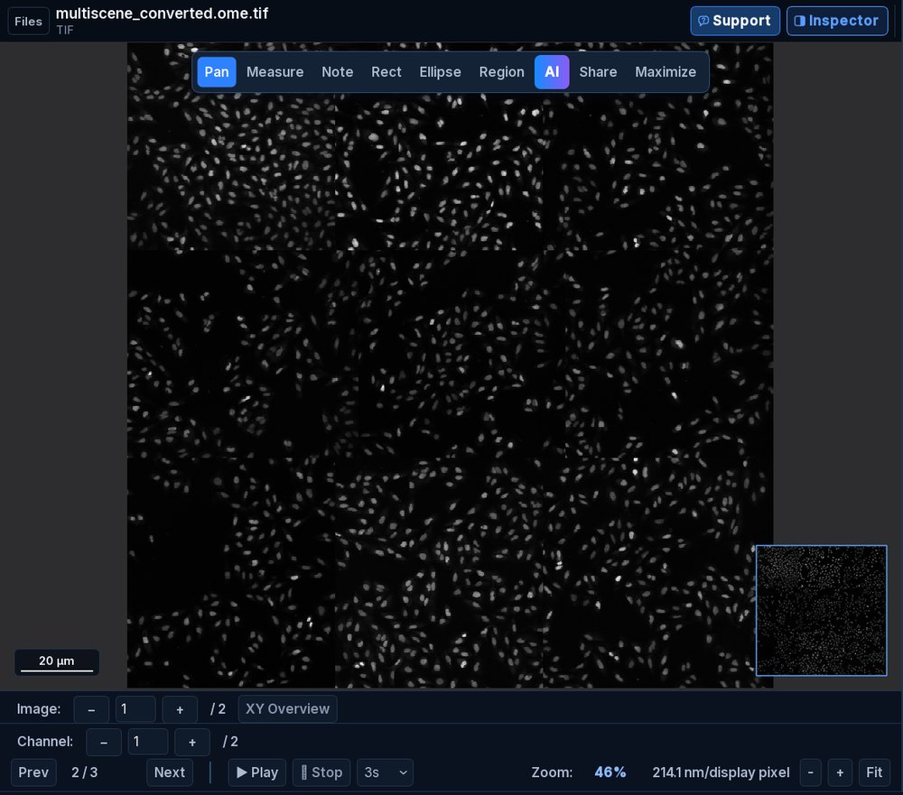 The exported OME-TIFF reopened in SlideScope, showing image 2 of 2 with the 20 µm scale bar intact.