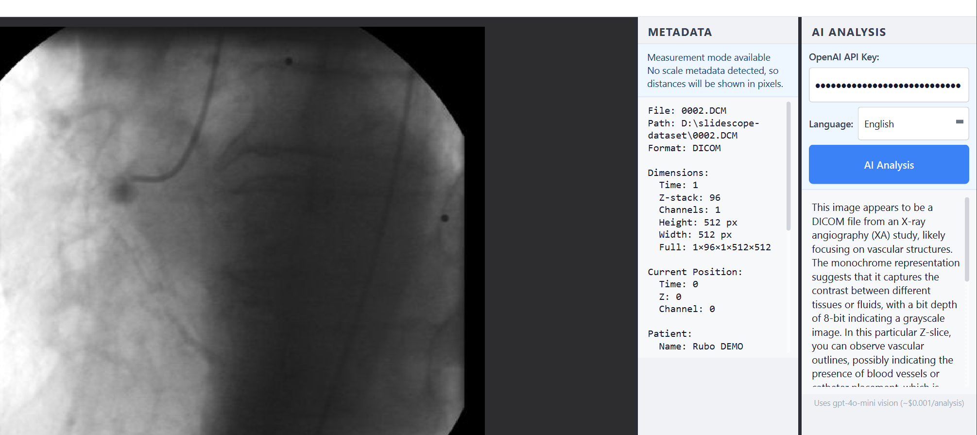 SlideScope AI Analysis panel open beside an image in the desktop viewer.