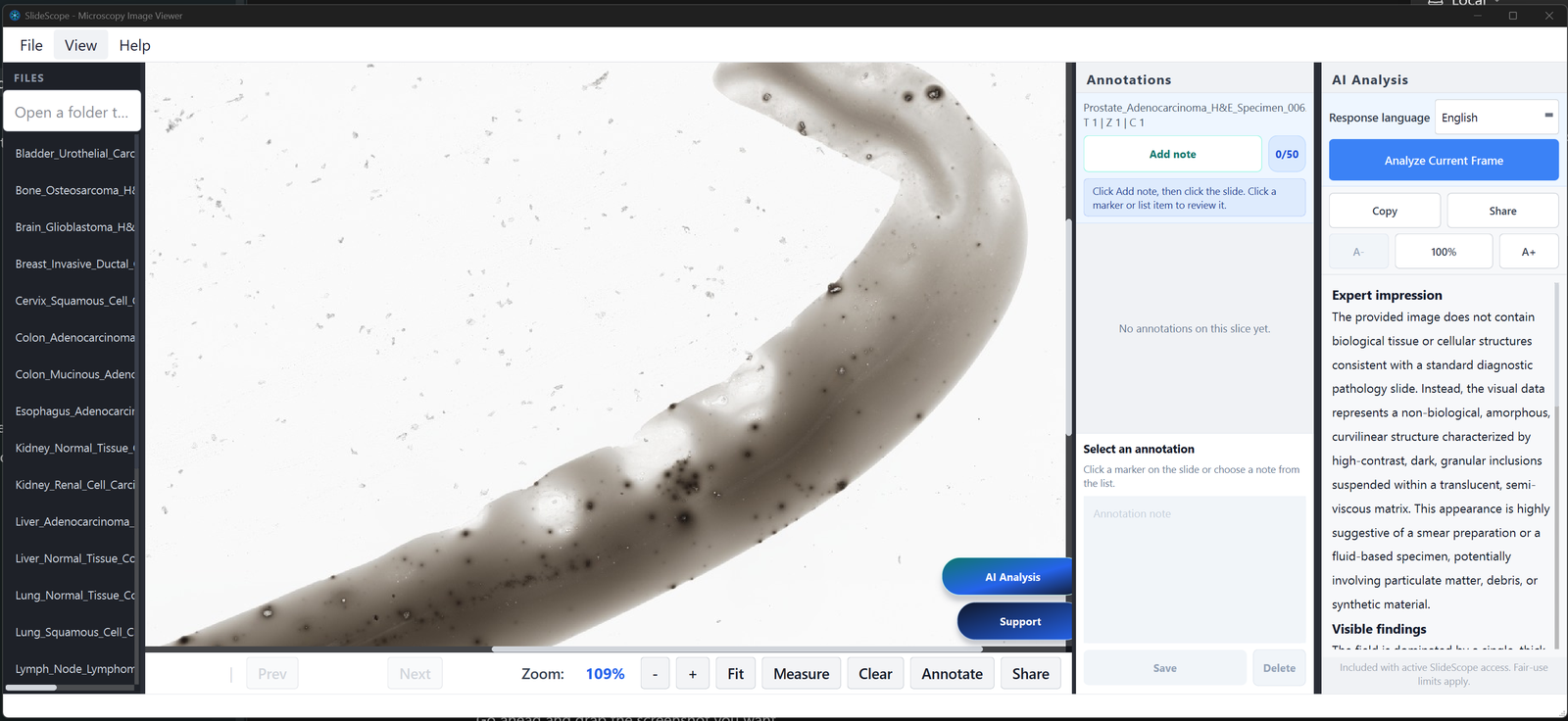 SlideScope desktop viewer with a microscopy slide, annotations panel, and AI Analysis readout open.