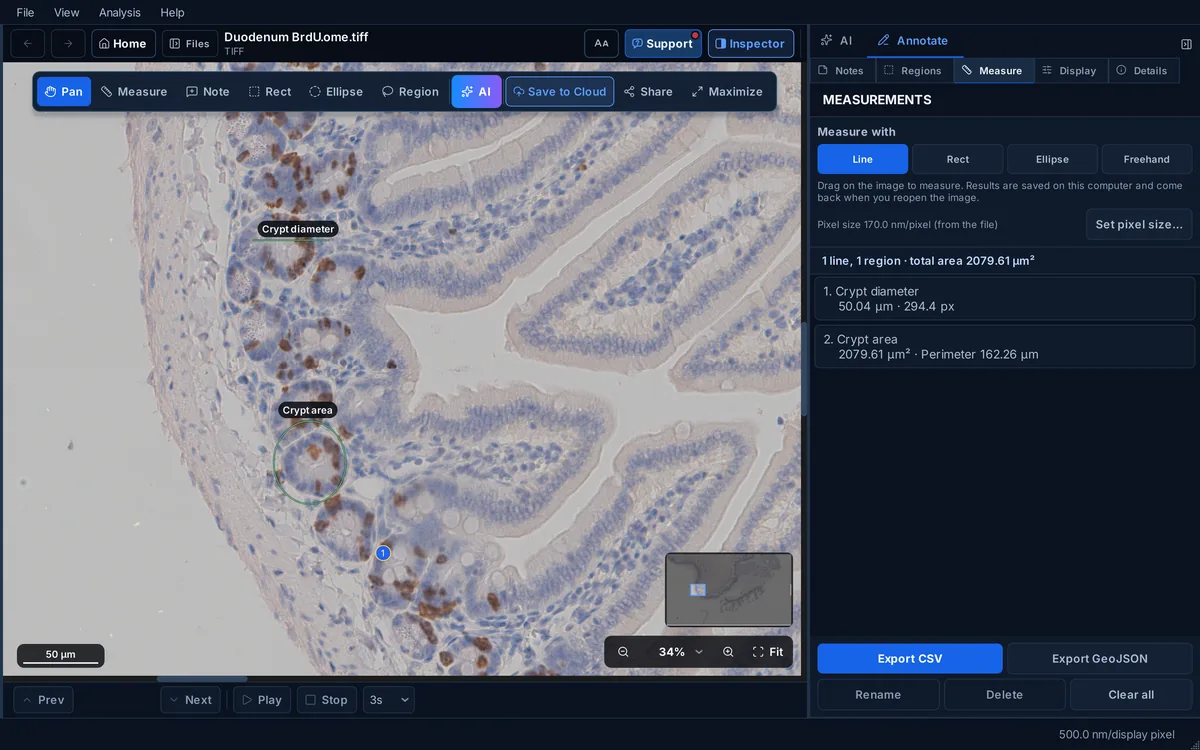 SlideScope viewer toolbar with Save to Cloud and Share buttons above a measured IHC section.