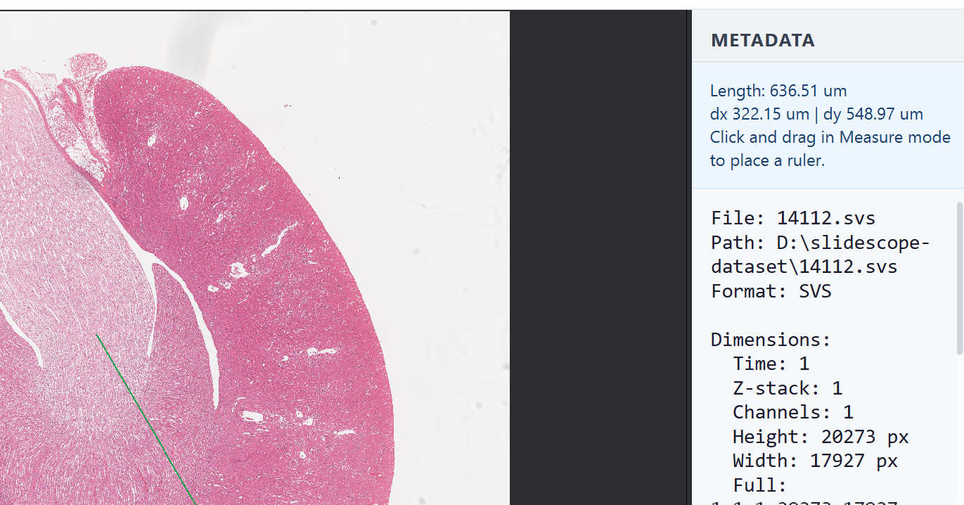 SlideScope desktop viewer with a calibrated measurement overlay on a microscopy image.