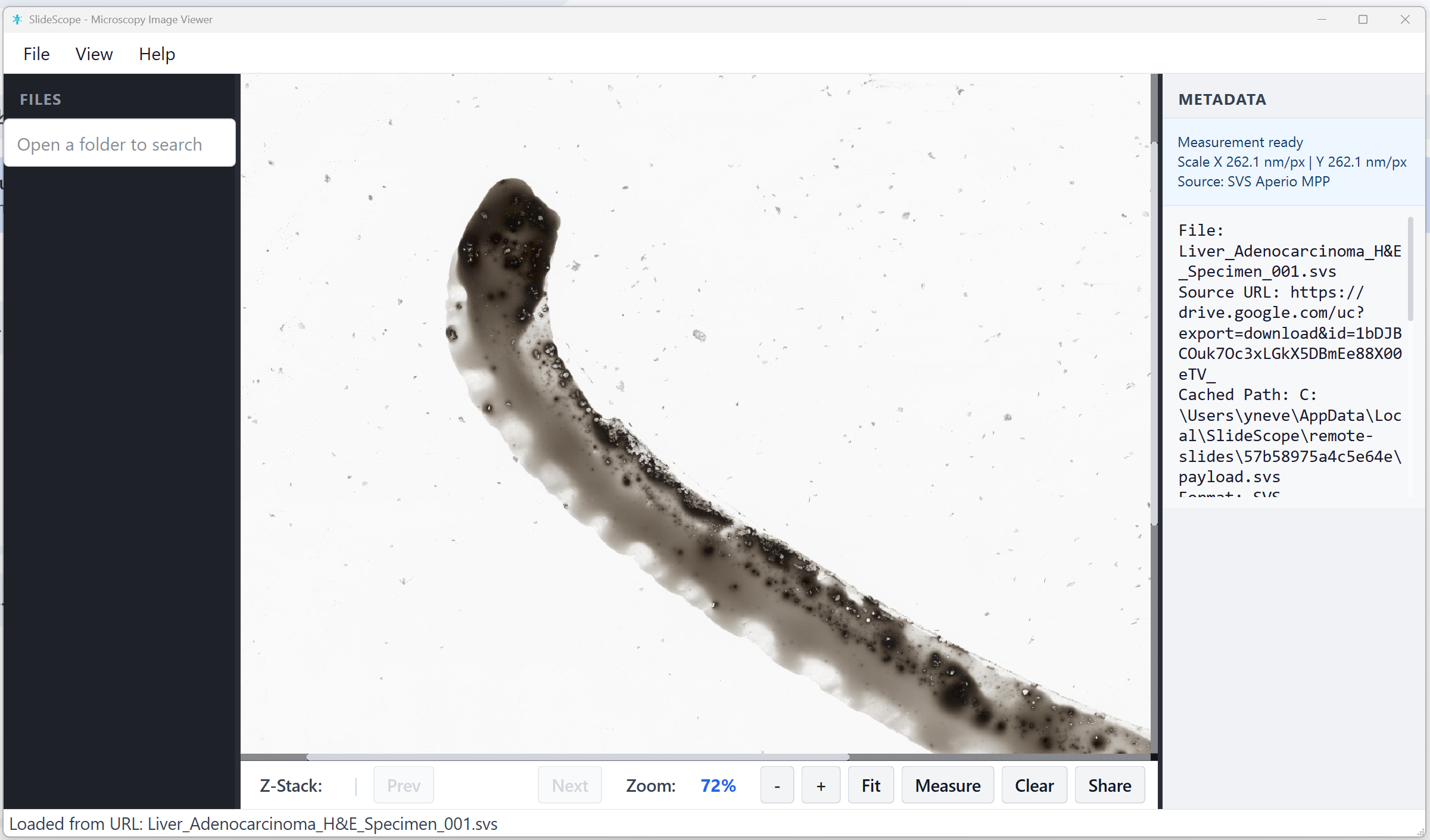 SlideScope desktop viewer showing a microscopy image loaded from a shared link with metadata visible.