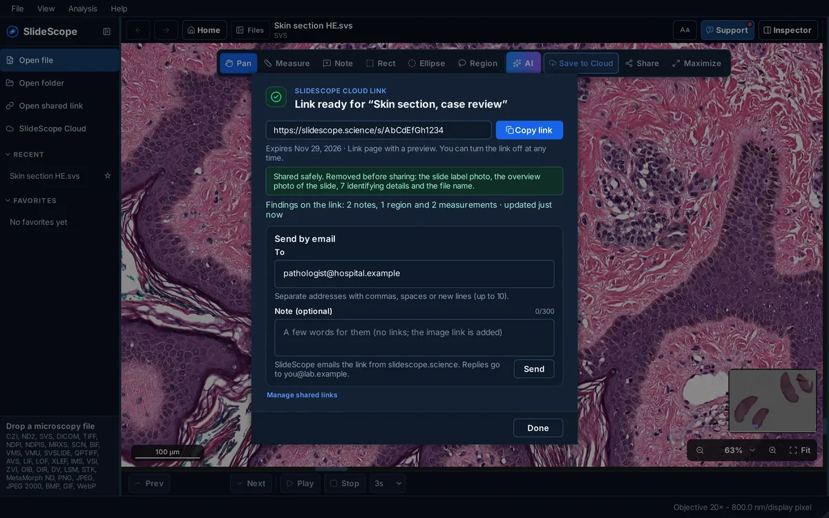 SlideScope Share dialog over an H&E skin slide: link ready with Copy link, expires Nov 29, 2026, a note that the slide label photo, overview photo, 7 identifying details and the file name were removed before sharing, findings on the link, and Send by email.