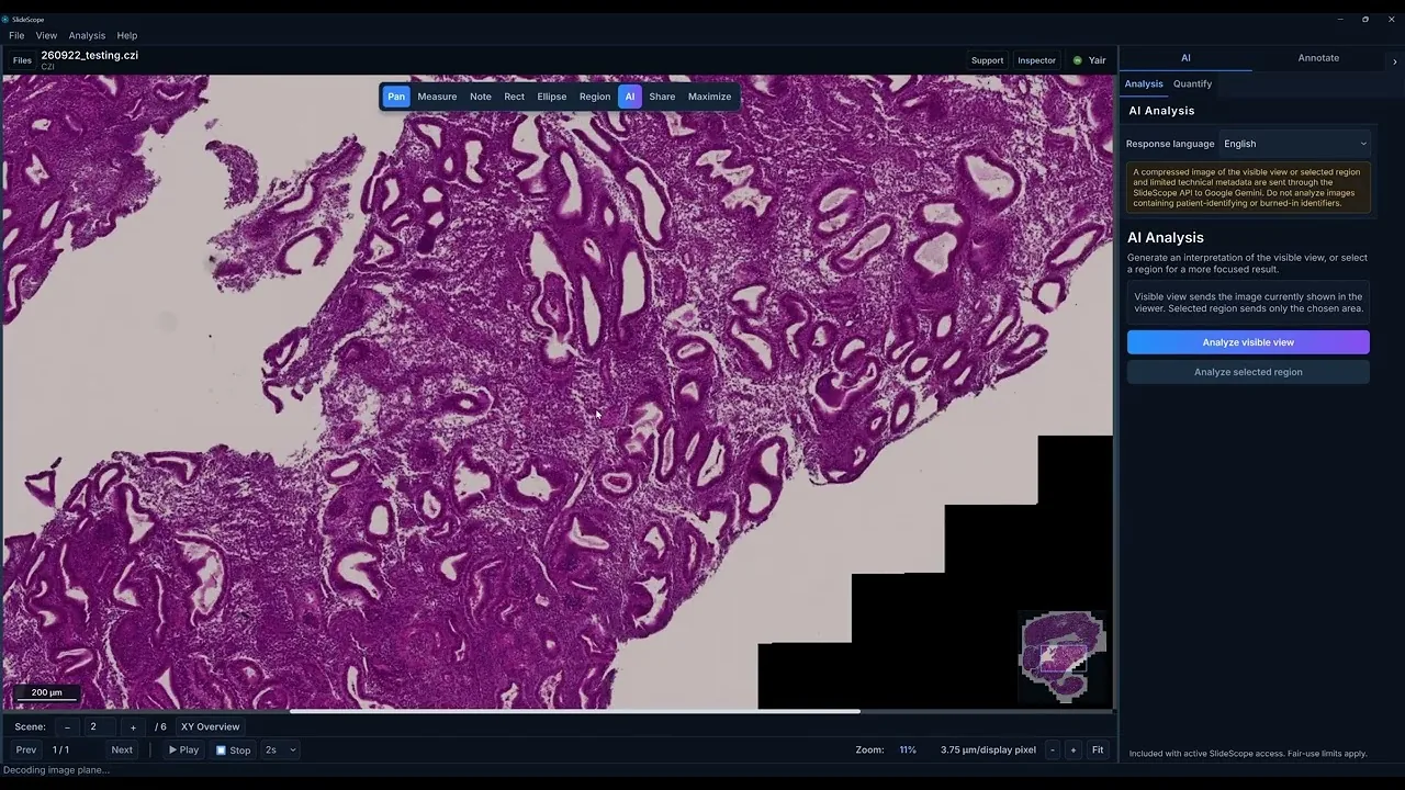 Pracovní prostředí SlideScope s patologickou tkání a nástroji pro navigaci a anotace